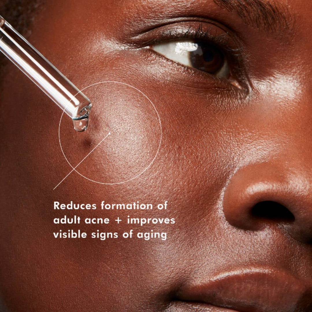 SkinCeuticals Blemish and Age Defense 30ml - Aesthetic Code